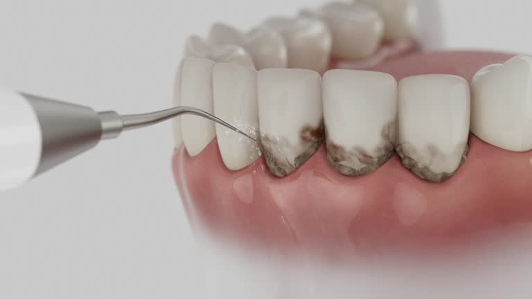 Reliable Dental contractor in Arab, AL by Smile Center Dentistry